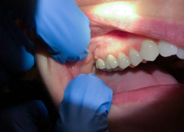 Best Broken Tooth Emergency  in Colmar Manor, MD