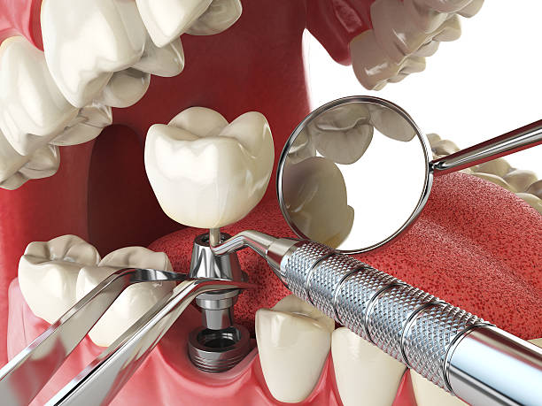 Best Affordable Emergency Dental Care  in Colmar Manor, MD